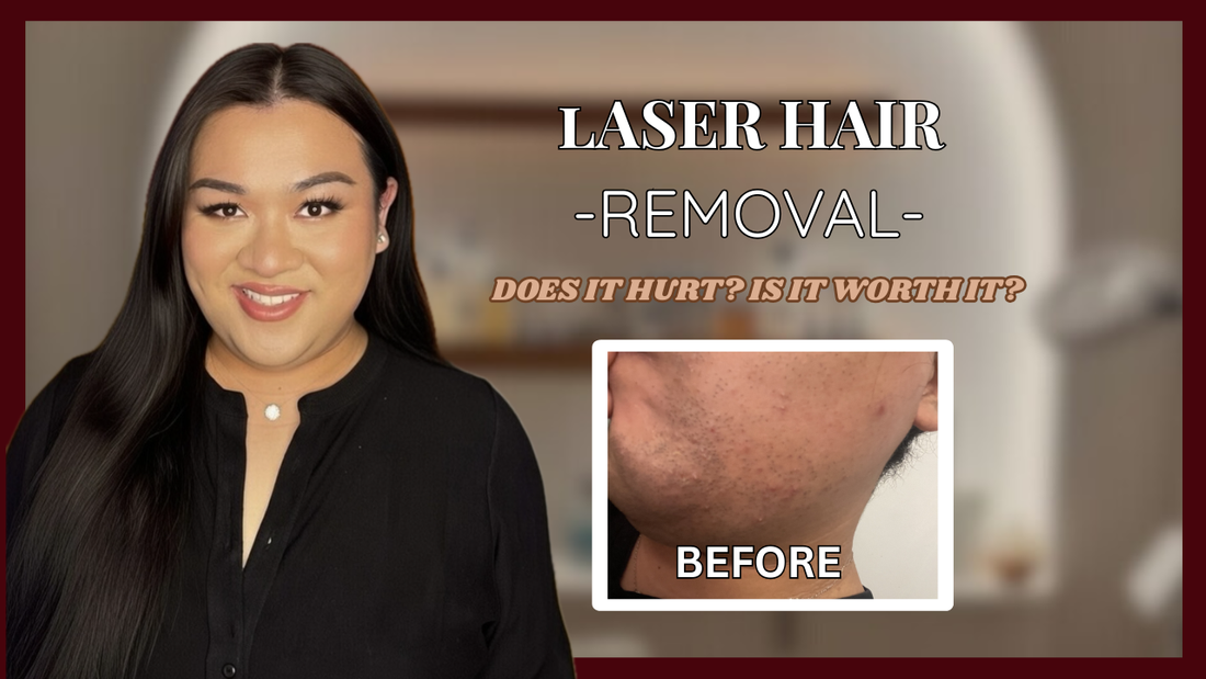 My First Laser Hair Removal Experience for Facial Hair: What to Expect, Side Effects, and Results